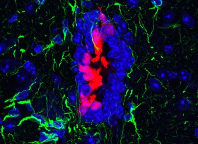 توانایی سلول‌های بنیادی در ترمیم آسیب‌های نخاعی 